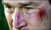 _1759881_newbush300bruise.jpg 11.74 KB
