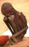 starving_child-sudan2.jpg 11.09 KB