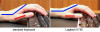 carpal-tunnel.jpg 21.81 KB